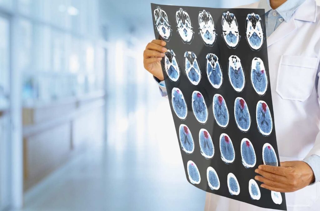 brain scan MRI brain surgery