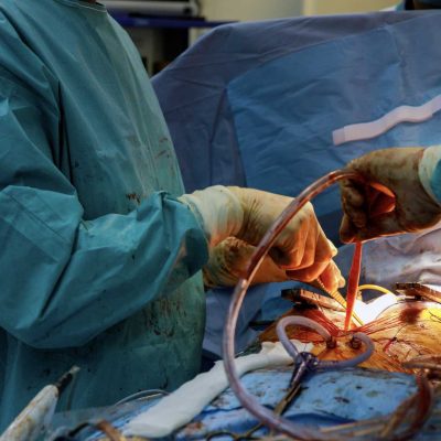 Specialized tools for minimally invasive cardiothoracic surgery, included the Yasui koplight