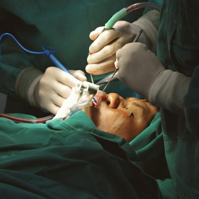 plastic surgery lighting – Yasui koplight LED retractor, breast surgery, cosmetic surgery