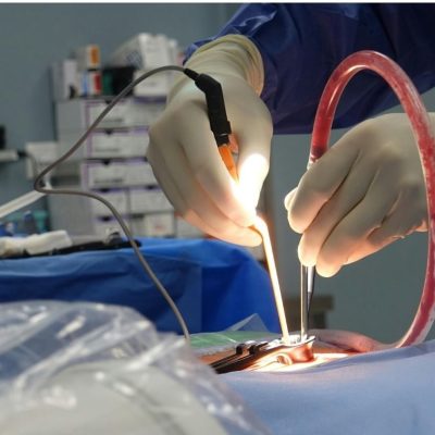 lighted retractors in surgery